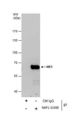 ME1 Antibody, Novus Biologicals 0.1 mL | Buy Online | Novus Biologicals | Fisher Scientific