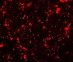 ME2 Antibody - BSA Free, Novus Biologicals 0.1 mg; Unconjugated:Antibodies,