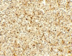 ME2 Antibody - BSA Free, Novus Biologicals 0.1 mg; Unconjugated:Antibodies,