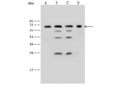 ME2 Antibody, Novus Biologicals:Antibodies:Primary Antibodies