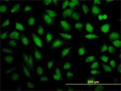 MED16 Antibody (2B7), Novus Biologicals 0.1 mg | Buy Online | Novus Biologicals | Fisher Scientific