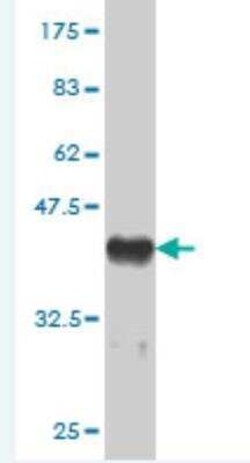 MED16 Antibody (3F5), Novus Biologicals 0.1 mg | Buy Online | Novus Biologicals | Fisher Scientific