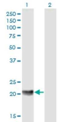 MED18 Antibody, Novus Biologicals 0.05 mg | Buy Online | Novus Biologicals | Fisher Scientific