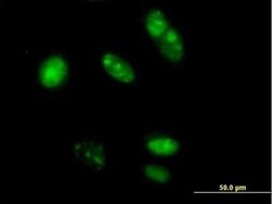 Novus Biologicals MED20 Antibody, Novus Biologicals 0.05 mg | Buy Online | Novus Biologicals&trade; | Fisher Scientific