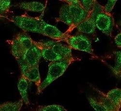 MED21 Mouse anti-Human, Clone: PCRP-MED21-4B5, Novus Biologicals:Antibodies:Primary