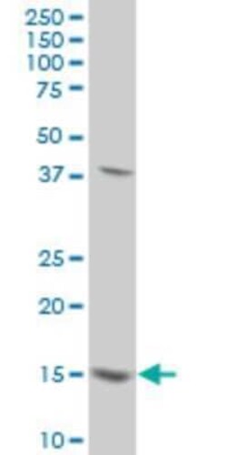 MED21 Antibody (2D9), Novus Biologicals 0.1 mg | Buy Online | Novus Biologicals | Fisher Scientific