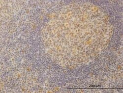 MED21 Antibody (3E9), Novus Biologicals 0.1 mg | Buy Online | Novus Biologicals | Fisher Scientific