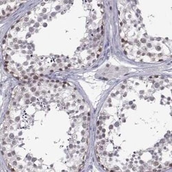 MED26 Antibody, Novus Biologicals:Antibodies:Primary Antibodies
