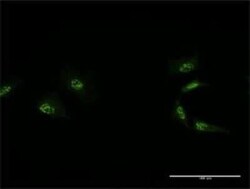 MED4 Antibody (2B10), Novus Biologicals 0.1 mg | Buy Online | Novus Biologicals | Fisher Scientific
