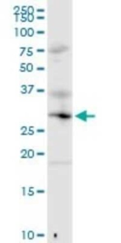 MED6 Antibody, Novus Biologicals 0.1 mg | Buy Online | Novus Biologicals | Fisher Scientific