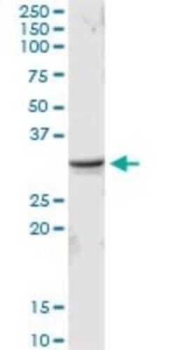 MED6 Antibody, Novus Biologicals 0.1 mg | Buy Online | Novus Biologicals | Fisher Scientific