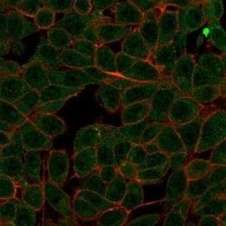 MED7 Mouse anti-Human, Clone: PCRP-MED7-1B8, Novus Biologicals 20 &mu;g;