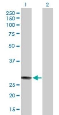 MED7 Antibody, Novus Biologicals 0.05 mg | Buy Online | Novus Biologicals | Fisher Scientific