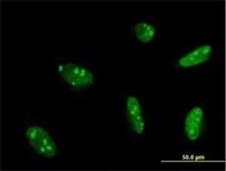 MEF2A Antibody (1A10), Novus Biologicals 0.1 mg | Buy Online | Novus Biologicals | Fisher Scientific