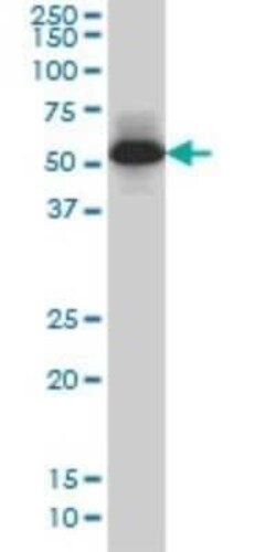 MEF2A Antibody (1A10), Novus Biologicals 0.1 mg | Buy Online | Novus Biologicals | Fisher Scientific