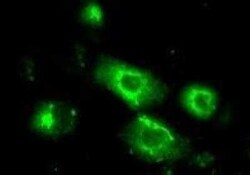 MEF2A Antibody (1C8), Novus Biologicals 0.1 mg | Buy Online | Novus Biologicals | Fisher Scientific
