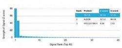 MEF2B Mouse anti-Human, Clone: PCRP-MEF2B-2F9, Novus Biologicals 100 &mu;g;