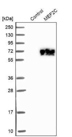 MEF2C Antibody, Novus Biologicals 0.1 mL | Buy Online | Novus Biologicals | Fisher Scientific