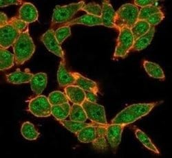 MEF2D Mouse anti-Human, Clone: PCRP-MEF2D-3A4, Novus Biologicals 20 &mu;g;