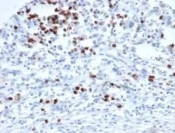 MEF2D Mouse anti-Human, Clone: PCRP-MEF2D-3A4, Novus Biologicals 20 &mu;g;