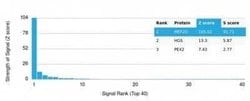 MEF2D Mouse anti-Human, Clone: PCRP-MEF2D-3A4, Novus Biologicals 20 &mu;g;