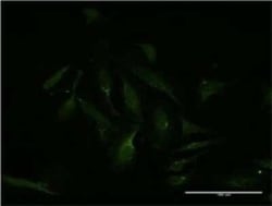 MEF2D Antibody (3A11), Novus Biologicals 0.1 mg | Buy Online | Novus Biologicals | Fisher Scientific