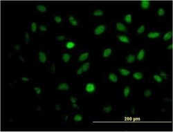 MEIS2 Antibody (1D1), Novus Biologicals 0.1 mg, Unconjugated:Antibodies,
