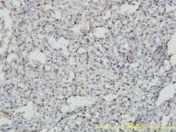 MEIS2 Antibody (1H4), Novus Biologicals 0.1 mg | Buy Online | Novus Biologicals | Fisher Scientific