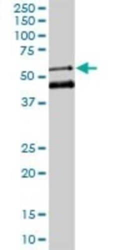 MEIS2 Antibody (1H4), Novus Biologicals 0.1 mg | Buy Online | Novus Biologicals | Fisher Scientific