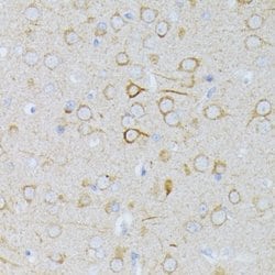 ENT1 Rabbit anti-Human, Mouse, Rat, Polyclonal, Novus Biologicals 100 &mu;L;