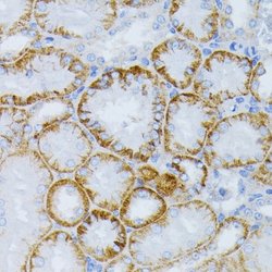 Sirtuin 3/SIRT3 Rabbit anti-Human, Mouse, Rat, Polyclonal, Novus Biologicals:Antibodies:Primary