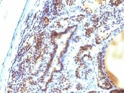MEKK1 Antibody (2F6), Novus Biologicals 0.02mg; Unlabeled:Antibodies, Monoclonal