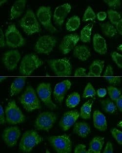 RNF2 Rabbit anti-Human, Mouse, Rat, Polyclonal, Novus Biologicals 100 &mu;L;
