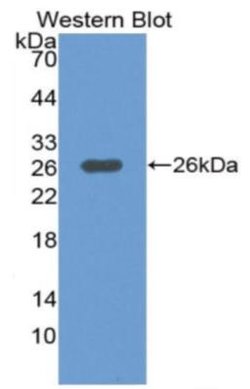 MEKK1 Antibody, Novus Biologicals 50 μL; Unconjugated:Antibodies, Polyclonal