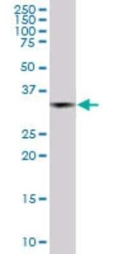 MEL-18 Antibody (4C10), Novus Biologicals 0.1 mg | Buy Online | Novus Biologicals | Fisher Scientific