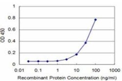 MEOX 2 Antibody (5E1), Novus Biologicals 0.1 mg | Buy Online | Novus Biologicals | Fisher Scientific