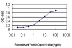 MEOX 2 Antibody (6A5), Novus Biologicals 0.1 mg | Buy Online | Novus Biologicals | Fisher Scientific