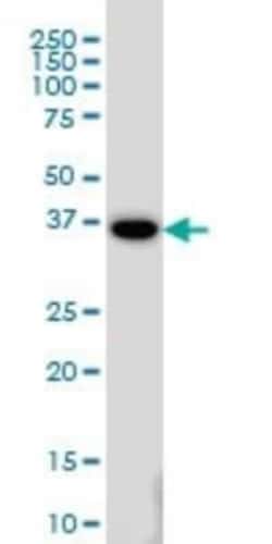 MEOX 2 Antibody (6A5), Novus Biologicals 0.1 mg | Buy Online | Novus Biologicals | Fisher Scientific