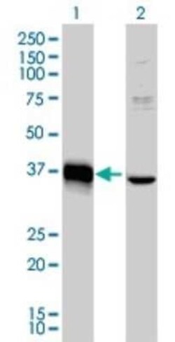 MEOX 2 Antibody (6A5), Novus Biologicals 0.1 mg | Buy Online | Novus Biologicals | Fisher Scientific