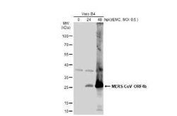 MERS-CoV ORF4b Antibody, Novus Biologicals 100 &mu;g | Buy Online | Novus Biologicals | Fisher Scientific