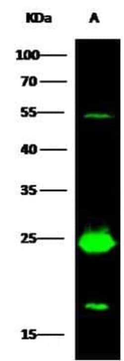 MESDC2 Antibody, Novus Biologicals:Antibodies:Primary Antibodies