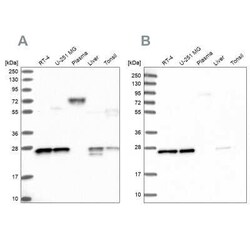 MESDC2 Antibody, Novus Biologicals 100 &mu;g; Unconjugated:Antibodies,
