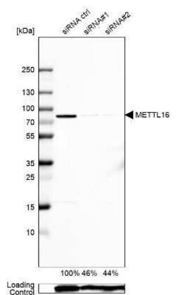 METT10D Antibody, Novus Biologicals:Antibodies:Primary Antibodies