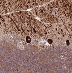METT11D1 Antibody, Novus Biologicals 100&mu;L; Unlabeled:Antibodies, Polyclonal