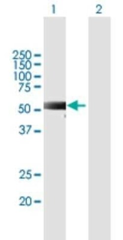 MEX3C Antibody, Novus Biologicals 50 &mu;g | Buy Online | Novus Biologicals | Fisher Scientific