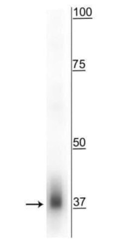 MFF Rabbit anti-Human, Mouse, Bovine, Polyclonal, Novus Biologicals 25