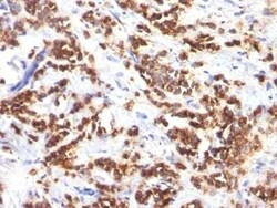 MFG-E8 Antibody (MFG-06), Novus Biologicals 0.02mg; Unlabeled:Antibodies,