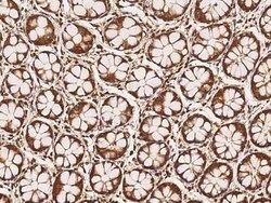 MFSD11 Antibody, Novus Biologicals 100 &mu;g; Unconjugated:Antibodies,