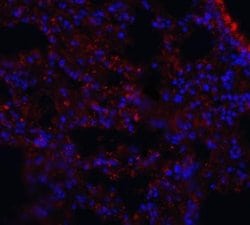 MFSD2 Antibody - BSA Free, Novus Biologicals 0.1 mg; Unconjugated:Antibodies,
