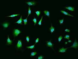 MGA Antibody, Novus Biologicals 50 &mu;g | Buy Online | Novus Biologicals | Fisher Scientific